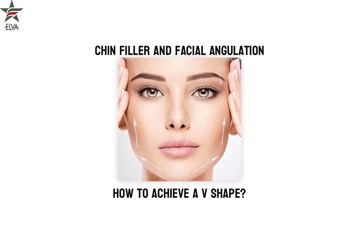 فیلر چانه و زاویه  سازی صورت: چگونه به فرم V برسیم؟