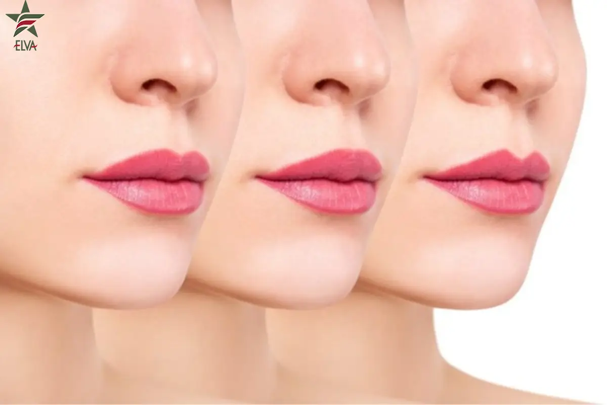 راهنمای جامع انتخاب فیلر لب