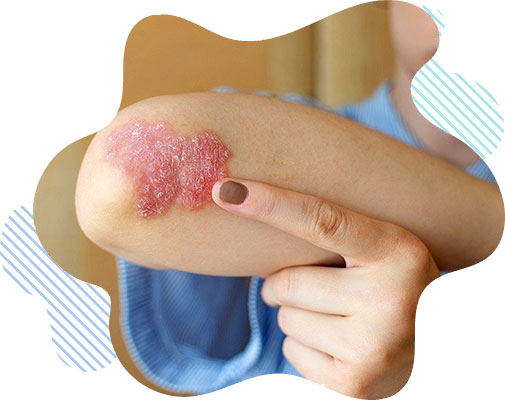 درمان بیماری های پوست و مو