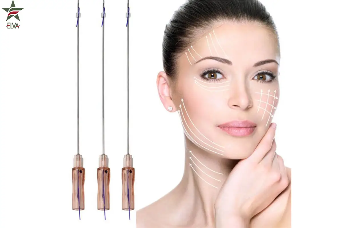 لیفت با نخ برای چه کسی مناسب است؟