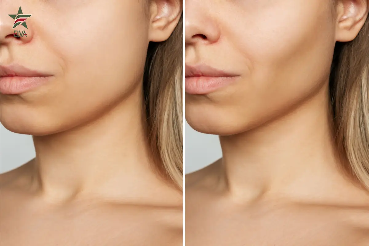 مزایای اصلی تخلیه بوکال فت