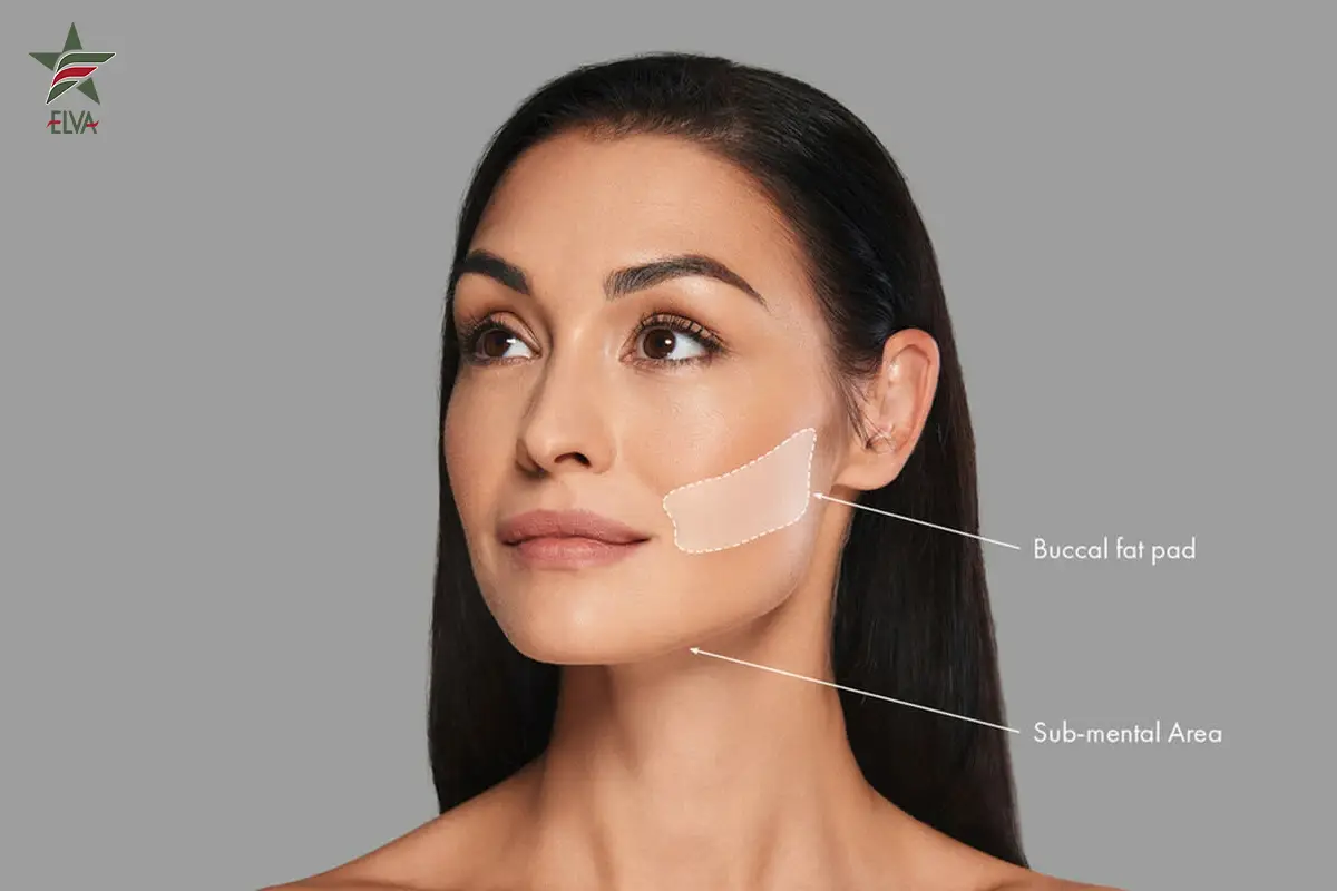 مشاوره دقیق