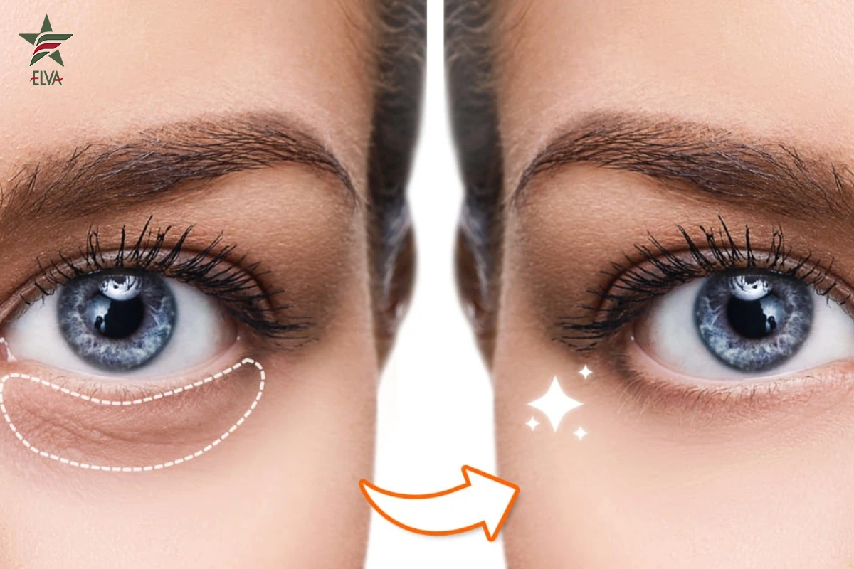 اما چگونه این کار به رفع تیرگی ها کمک می کند؟