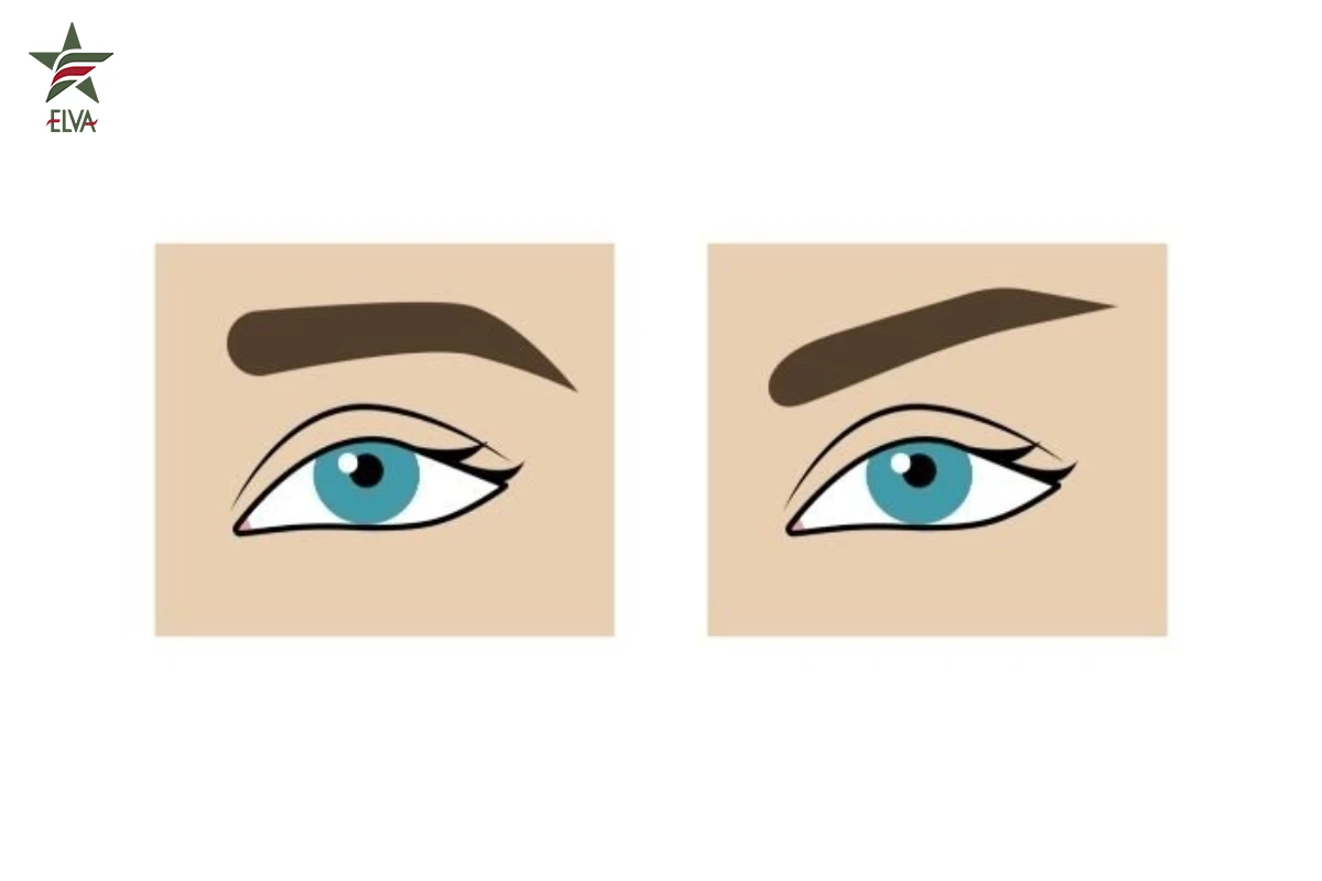 سوال کلیدی: ماندگاری لیفت چشم روباهی با نخ چقدر است؟