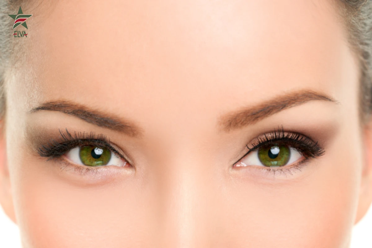 مزایا بوتاکس چشم روباهی