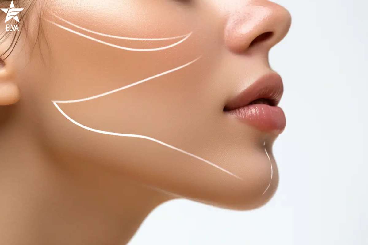 فیلر چانه و زاویه سازی صورت مناسب چه کسانی است؟